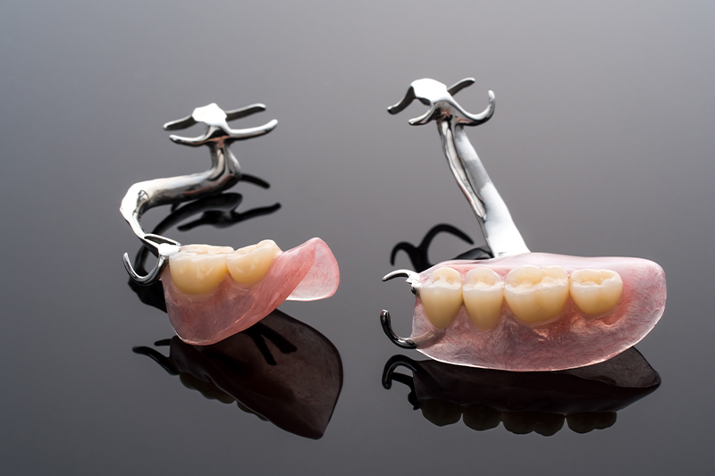 欠損治療の選択肢/入れ歯（義歯）