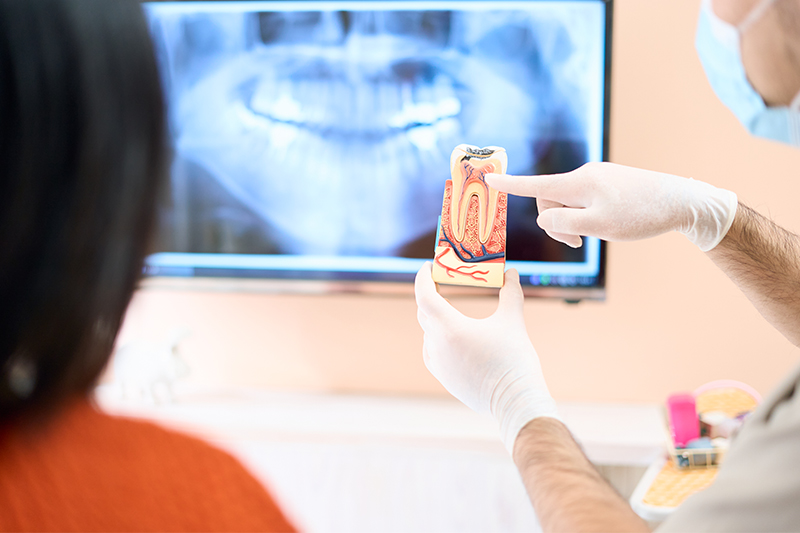 根管治療とは？